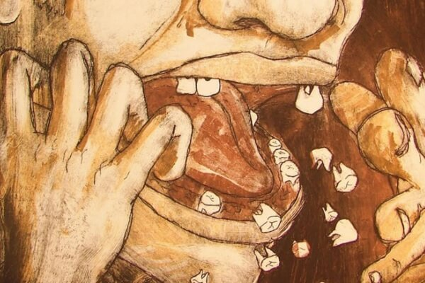 Mẻ răng là điềm gì? Giải mã những điều “bí ẩn”